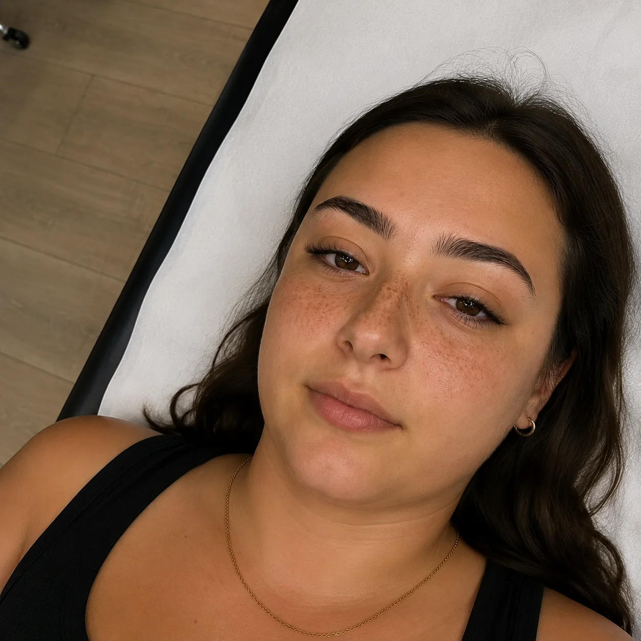 Résultat naturel de taches de rousseur personnalisées à Mulhouse